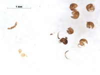 Chironomidae antenna base3