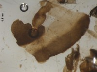 Chironomidae body fragment