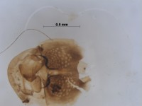 Chironomidae genital2