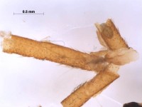 tipulidae leg