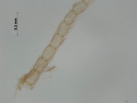 neuroptera antennae