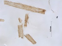 neuroptera leg